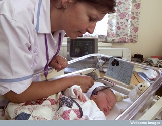 Teste da orelhinha sendo realizado num bebê